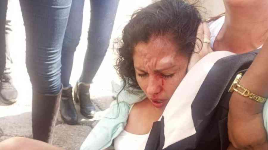 Hay indignación por la brutal golpiza a la asambleísta Muriel Cruz del MAS
