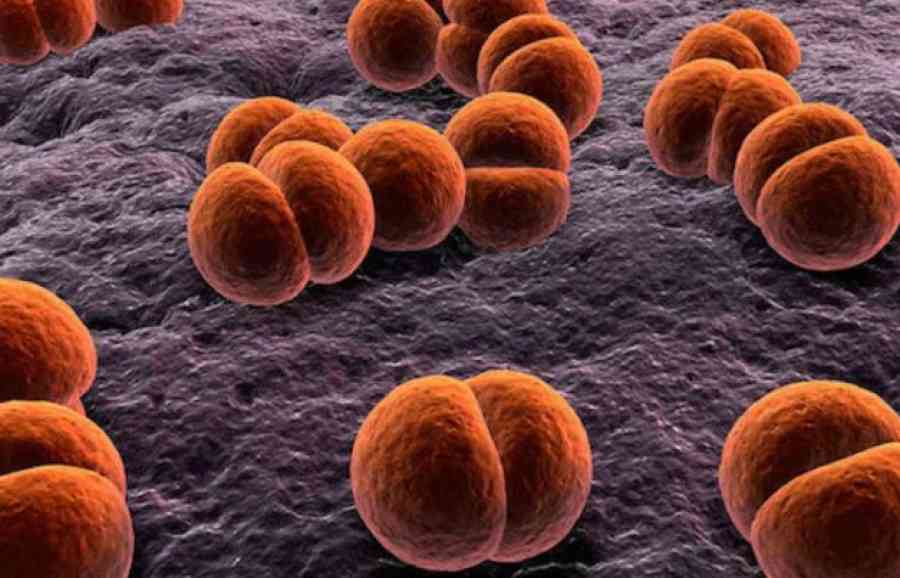 Descartan caso sospechoso de meningitis en Bermejo