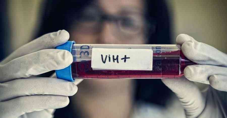 Aumentan los casos de VIH en Tarija, hay 22 diagnosticados