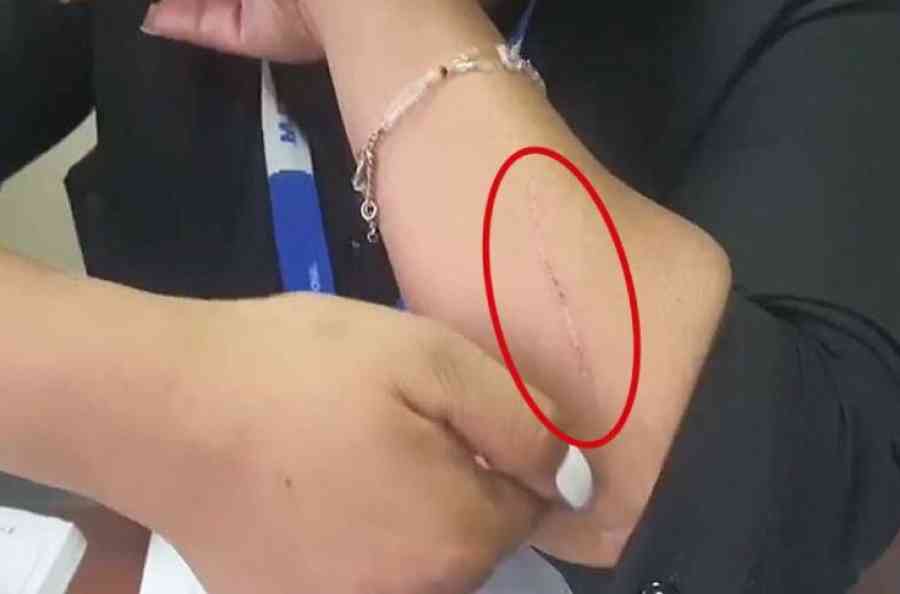 Con cuchillo en mano, intimidan a defensora del consumidor durante control en Tarija