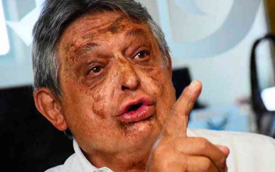 Jaime Paz dice que sin pensión de expresidente tendría que pedir limosna ‘¿con qué vivo?’